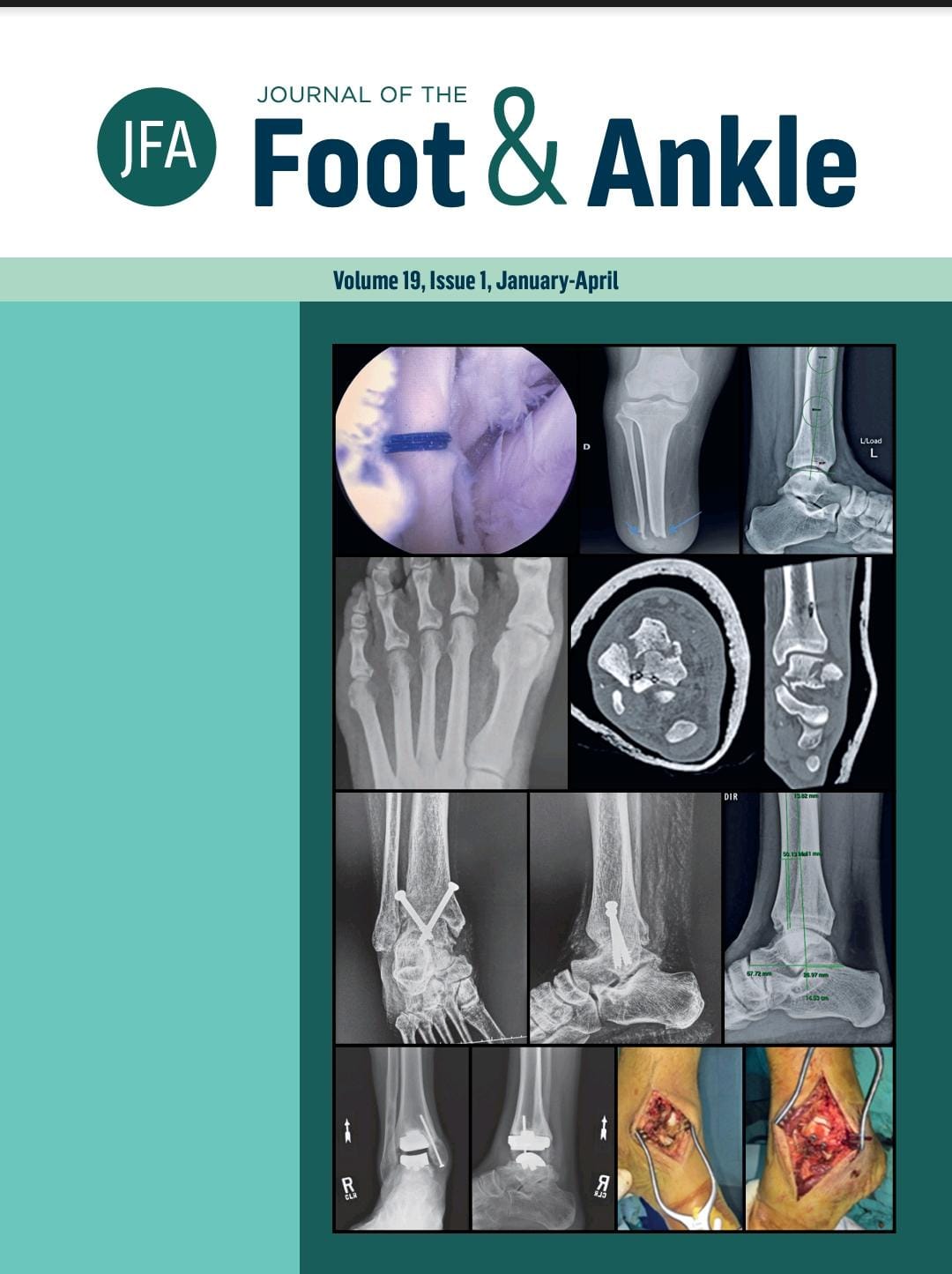 					View Vol. 20 No. 2 (2026):  Journal of the Foot and Ankle
				